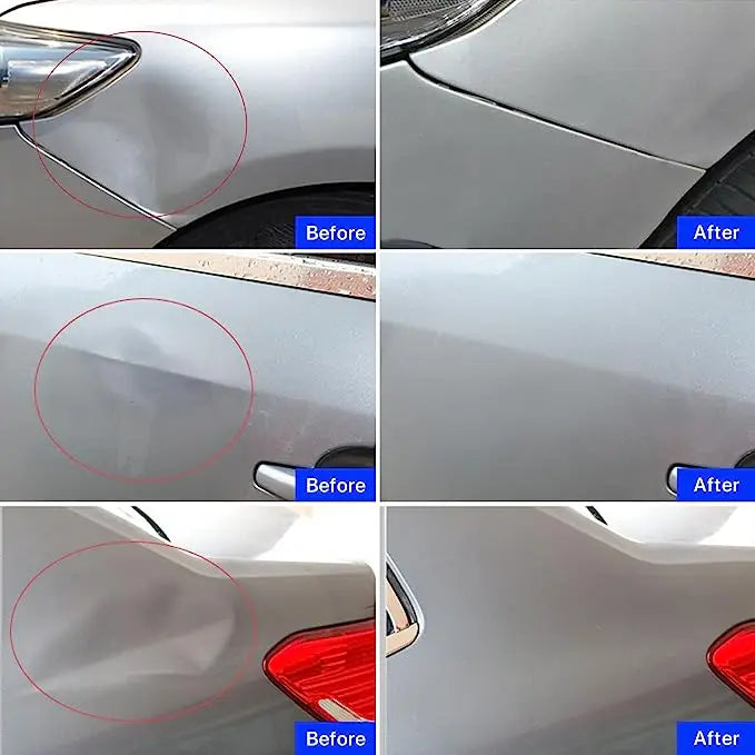 Car Dent Repair Puller Kit – Paintless Auto Body Dent Removal Tool